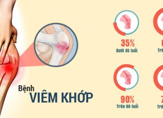 benh viem khop trieu chung va dieu tri
